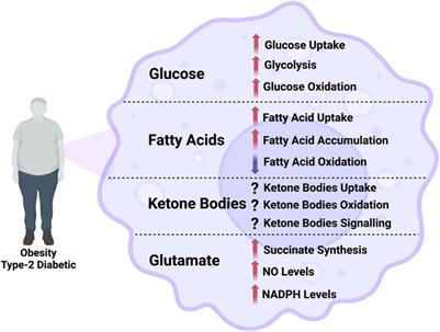 Metabolic flux in macrophages in obesity and type-2 diabetes